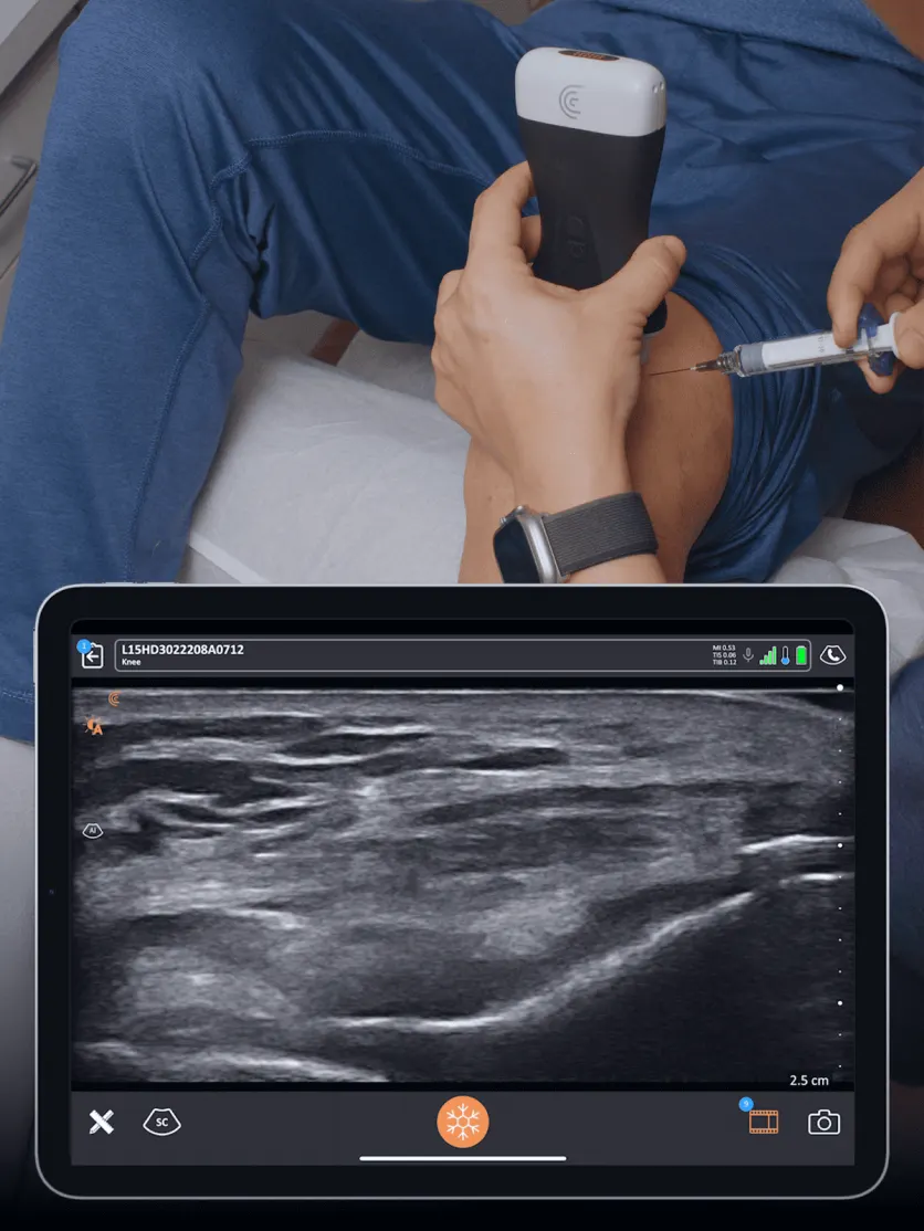 An ultrasound-guided joint injection, with the live ultrasound image on a tablet