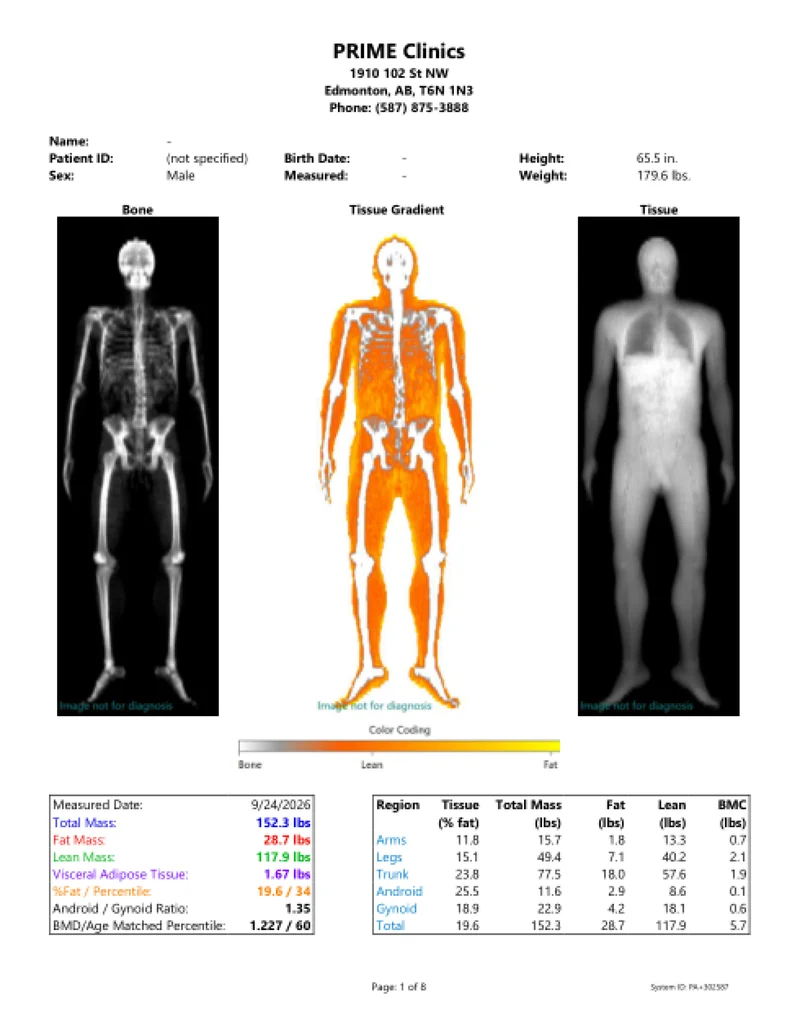 Page 1 of a sample PRIME Clinics DEXA body composition report